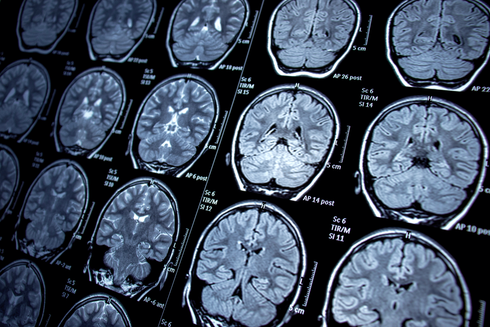 Photo showing a series of brain scan DICOM images in TrialKit PACS