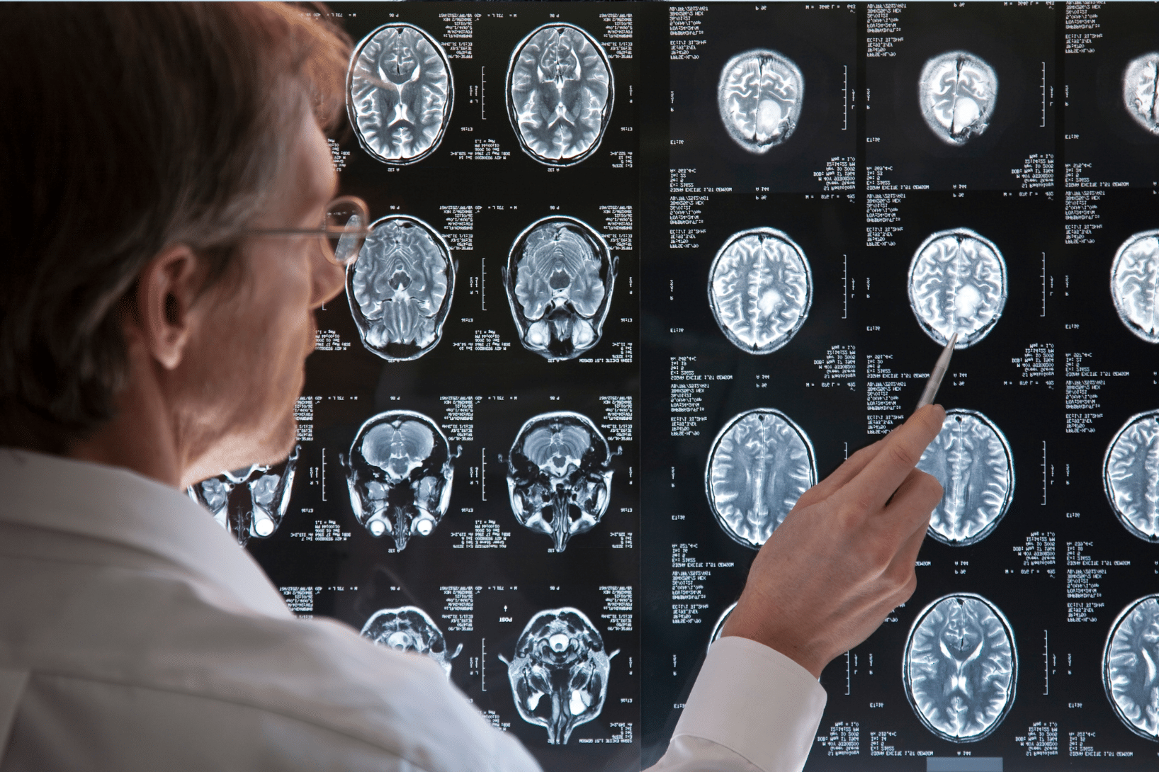 Visualization of TrialKit PACS, showcasing advanced imaging solutions integrated with clinical trial management for streamlined workflows